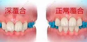 长期不合区的传奇私服